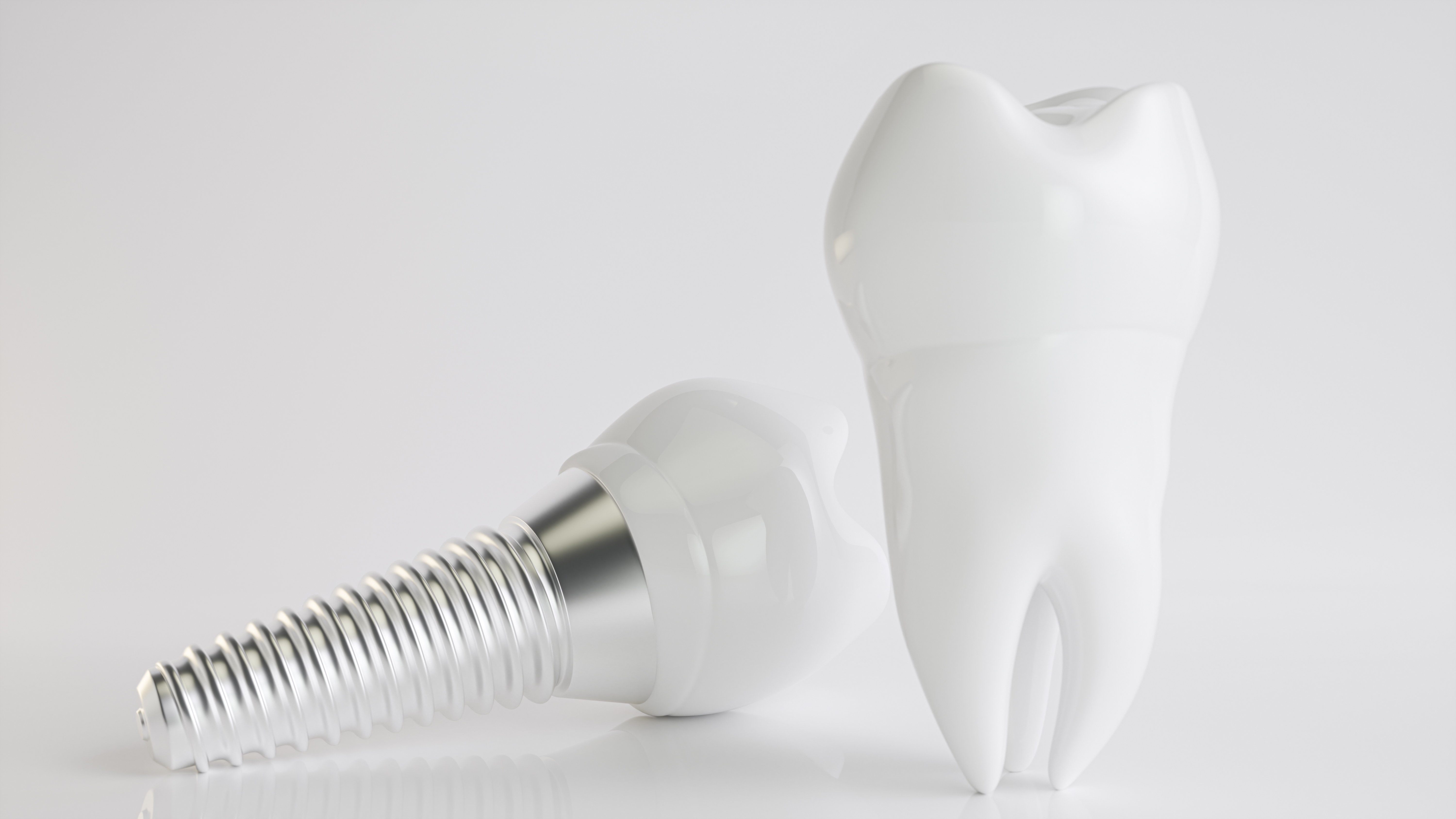 Praxis für Implantate, Zahnarzt für Implantate, Feldkirch